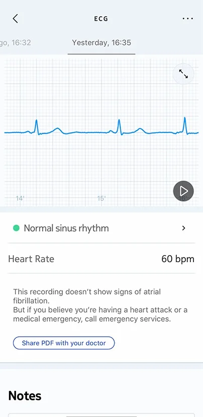 Withings Scanwatch 2 ECG Measurement