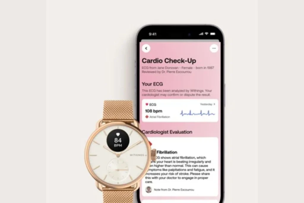 Withings ScanWatch 2 Cardio Check-up; Withings ScanWatch 2 review