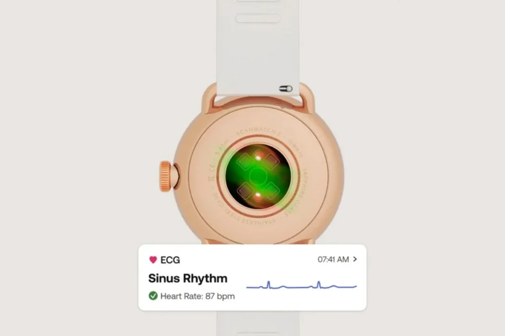Withings ScanWatch 2 ECG; Withings ScanWatch 2 review